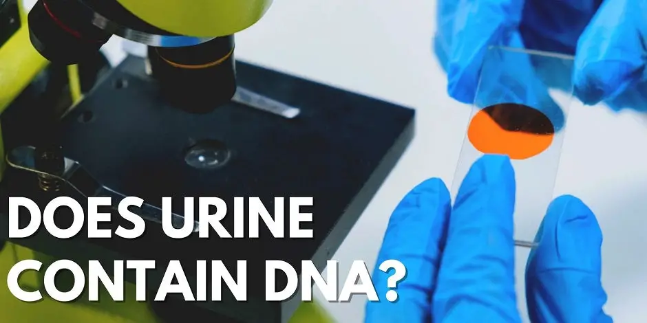 Does Urine Contain DNA?